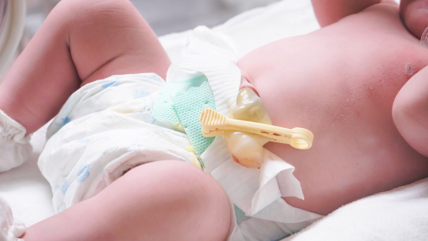 Delayed cord clamping